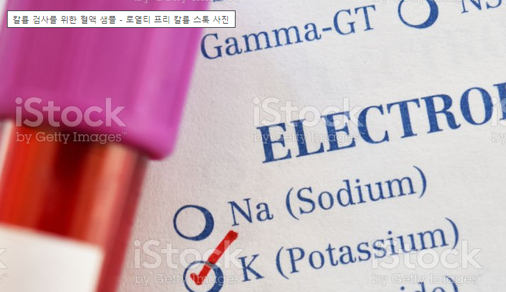 %EC%8B%9D%EB%8B%A8_1.png