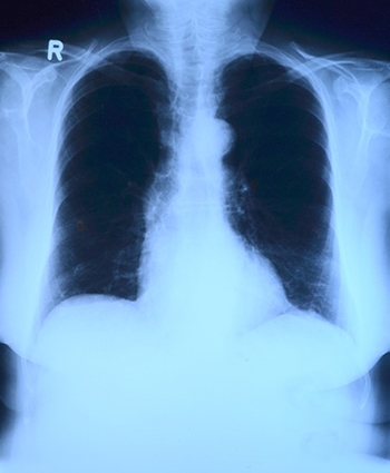 2%EC%9D%BC%EA%B8%B0%EC%82%ACx-ray-image-
