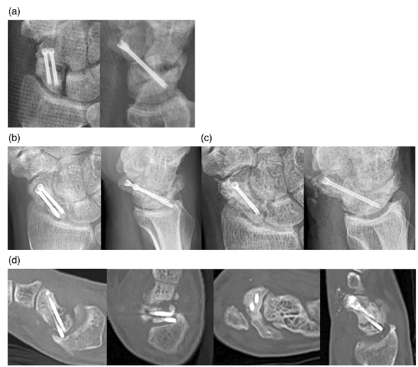 1_443.png